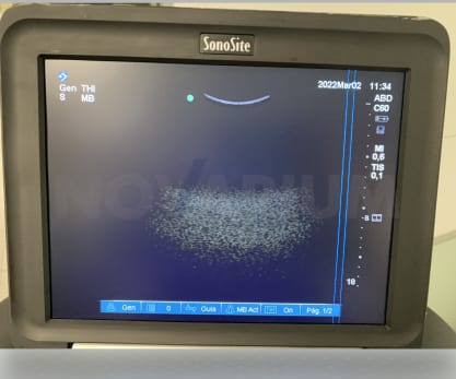 Sonosite p15000 - LCD Screen.png