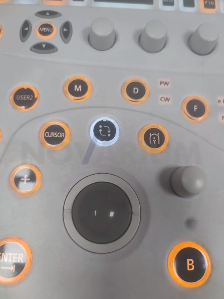 Aloka - Trackball (2).jpg