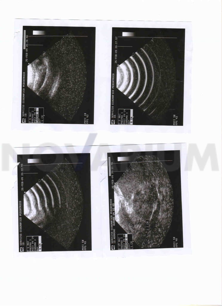 ATL 7.5-13 mm AA sn AL0656.jpg